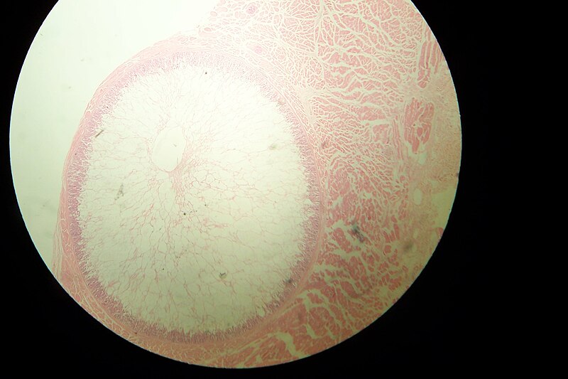 File:Sarcocystis in sheep oesophagus.JPG
