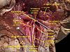 Músculos, arterias y nervios del cuello. Disección del recién nacido.