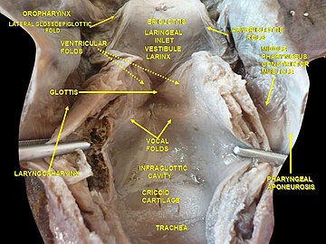 Larynx, pharynx and tongue. Deep dissection.Posterior view.