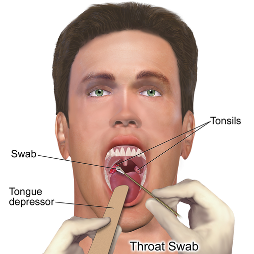 Throat Culture