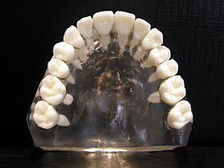 Upper jaw.jpg