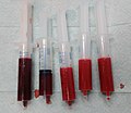 Venous and arterial blood rotated and cropped.jpg