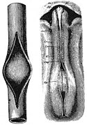 Wilhelm His Sr.'s chick embryo compared to a slit rubber tube