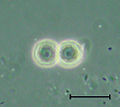 Codosiga sp. two conjoined cysts