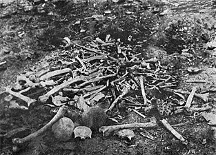 عظام لضحايا أرمن فى أذربيجان.