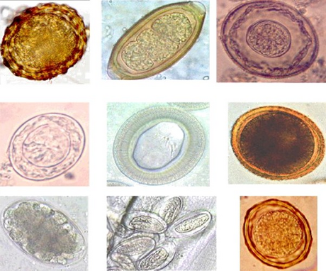 Parasitic worm