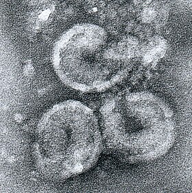 Micrografia eletrônica de partículas de torovírus equino, uma das espécies pertencentes a esta subfamília. Três partículas virais são mostradas, as quais possuem aproximadamente 100 nm de diâmetro cada e foram coloridas negativamente com molibdato de amônio.