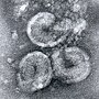 Vorschaubild für Torovirus