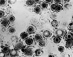 Електронна мікроскопія немодифікованого герпесвірусу
