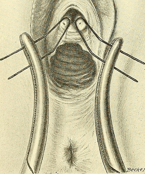 File:Operative gynecology - (1906) (14596924418).jpg