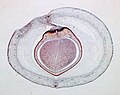 Light micrograph of a cross section of a Phaseolus fruit