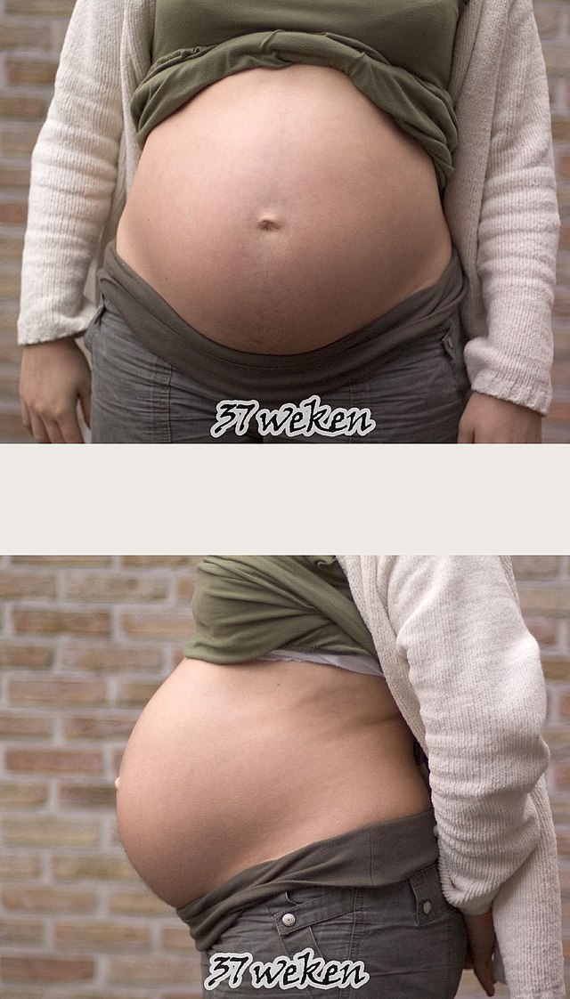 Первая беременность в 37. Естественная беременность в 37. 37.4 Недели беременности. Беременность в 37 и внешность. Симптомы беременности в 37 лет.