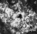 Thumbnail for Chrysochromulina ericina virus