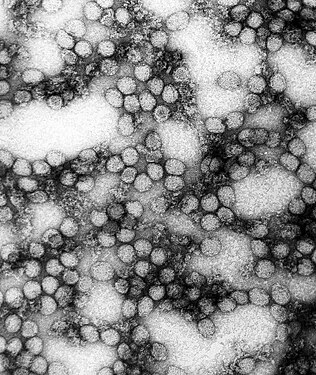Microfotografia de virions de la febre groga (234.000x)