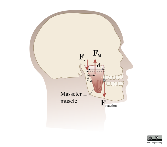 File:21-S-C5-JK-587-open-stasx-Problem-35-skull-bite-bullet.png