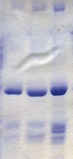 Proteins stained on a PAGE gel using Coomassie blue dye. Coomassie blue stained gel.png
