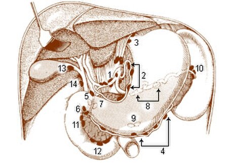 Right and left gastroomental is at #4.