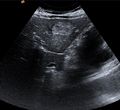 Medical Ultrasound