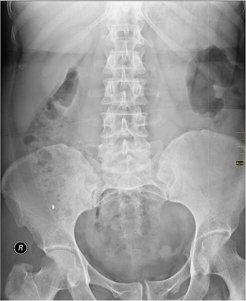 File:Medical X-Ray imaging UDG07 nevit.jpg