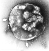 Sulfolobus infected with the DNA virus STSV1. Bar is 1 micrometer. RT8-4.jpg