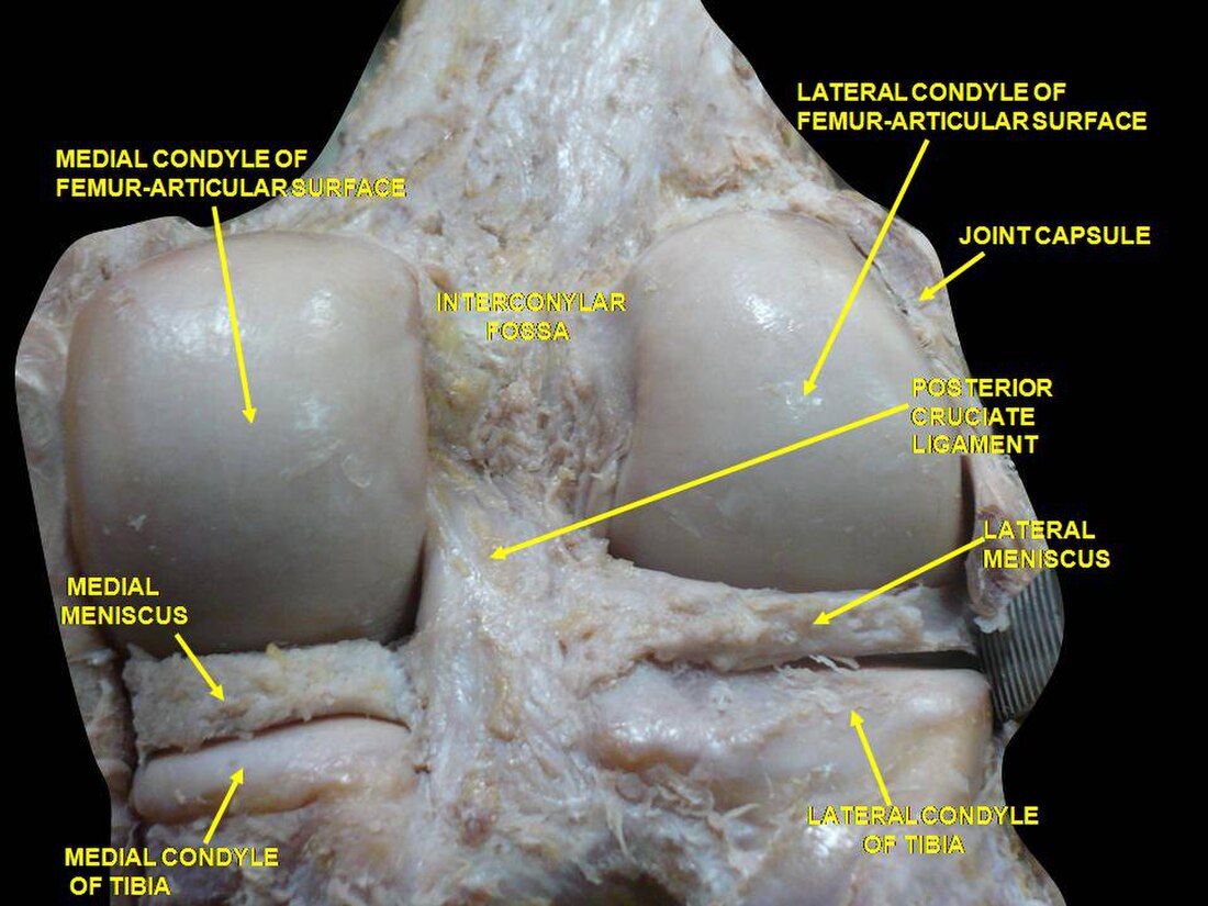 Condyle médial du fémur