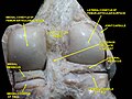 Vista posteriore, in dissezione profonda, del ginocchio destro in estensione. A destra è visibile il condilo laterale del femore