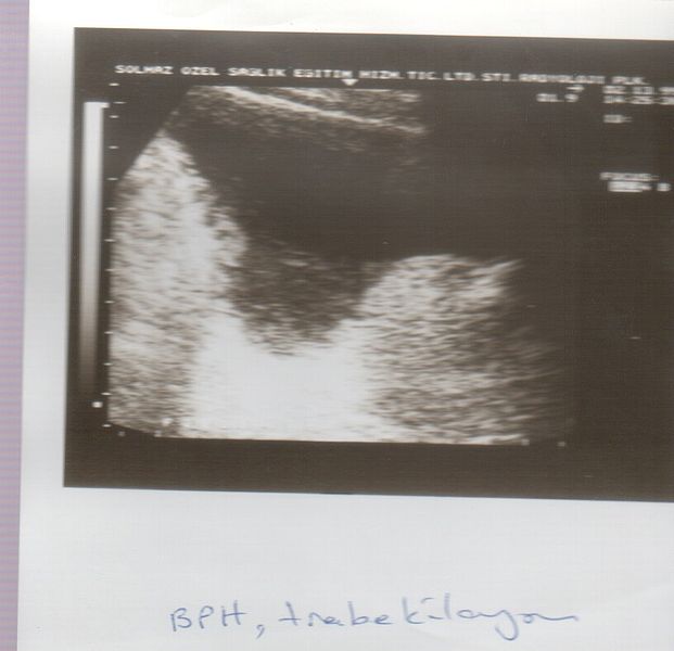 File:Ultrasound Scan ND 094.jpg