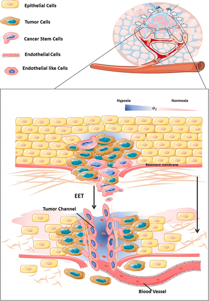 File:Vascular mimicry formation.webp