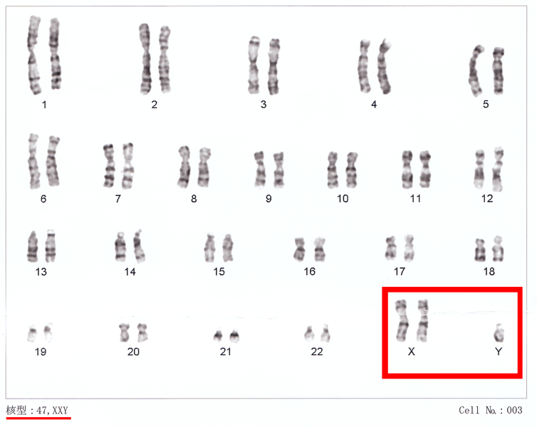 File:Human chromosomesXXY02.png