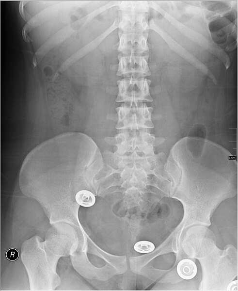 File:Medical X-Ray imaging COW03 nevit.jpg