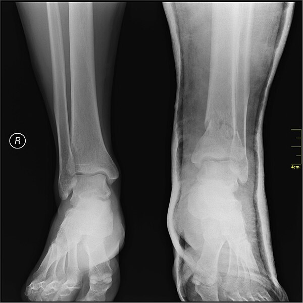 File:Medical X-Ray imaging NUV06 nevit.jpg