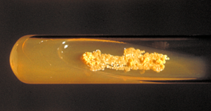 Colonies of Nocardia asteroides