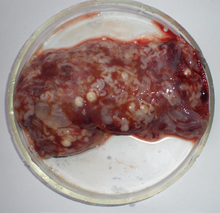 טפיל 140092-fig2 FIG 6 Cestoda Trypanorhyncha Molicola horridus in Diodon hystrix liver.png