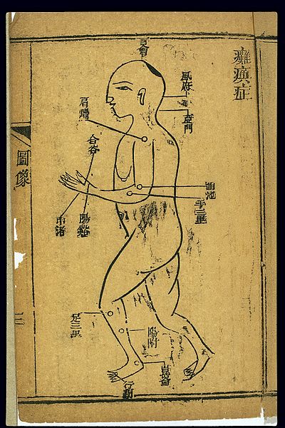 File:Points for treating paralysis, Chinese woodcut Wellcome L0037888.jpg