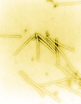 Электронная микрофотография вируса табачной мозаики — первого открытого вируса и первого описанного представителя Riboviria