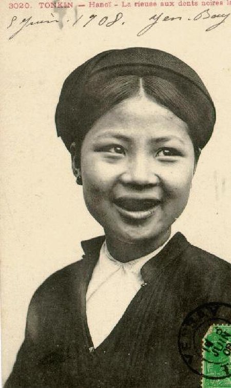 Nhuộm răng