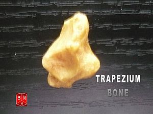 Trapezium bone.jpg