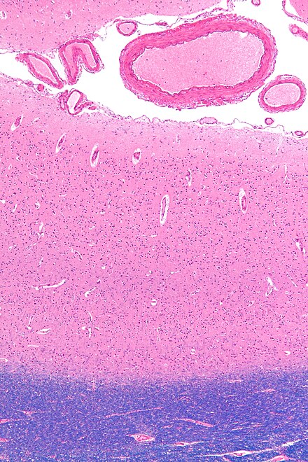 Micrograph showing the visual cortex (predominantly pink). Subcortical white matter (predominantly blue) is seen at the bottom of the image. HE-LFB stain.