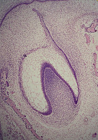 Histologic slide of tooth in early bell stage. Note cell organization. Earlybellstage11-18-05.jpg