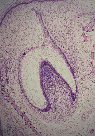 Эмалевый. Ранняя стадия развития зуба гистология препарат. Развитие зуба эмалевый орган гистология препарат. Развитие зуба эмалевый орган ранняя стадия. Ранняя стадия развития зуба эмалевый орган препарат гистология.