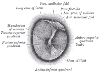 Tapón de cerumen: MedlinePlus enciclopedia médica