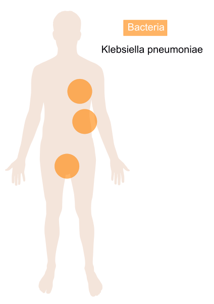 File:Klebsiella pneumoniae.svg