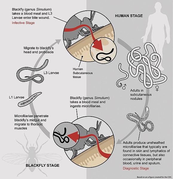 File:Life Cycle of Onchocerca volvulus PLoS Medicine.jpg