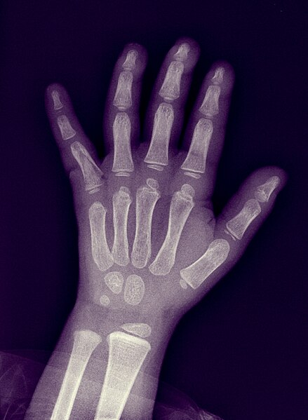 File:Medical X-Ray imaging KJC05 nevit.jpg