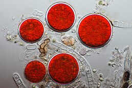 Цисти Haematococcus pluvialis, що містять астаксантин (дифференціальна інтерференціонно-контрастна мікроскопія)