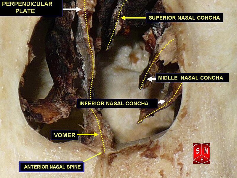 File:Nasal cavity - anterior view.jpg