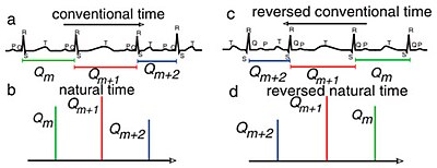 (a) ECG in which the RR distances are marked
(b) the same ECG plotted in (a) but read in natural time analysis
(c) ECG at conventional time upon time reversal
(d) ECG upon time reversal in natural time analysis
The length between RR distances in conventional time is approximately considered as the energy of each pulse (event) in natural time analysis. Natural time as applied in cardiology.jpg