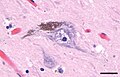 Neuromelanin in a neuron of the substantia nigra.jpg