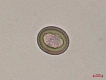 Mikroskopický záběr na vajíčko tasemnice chráněné odolným embryoforem, uvnitř patrná larva onkosféra. Podle doplněného měřítka měří vajíčko asi 40 mikrometrů