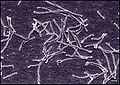 Thermus aquaticus osservato in microscopia elettronica.